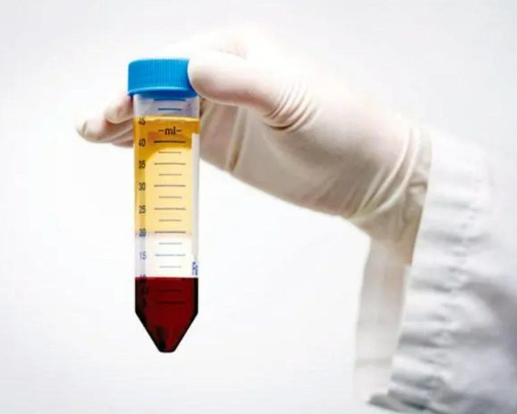 Blood in Centrifuge Tube