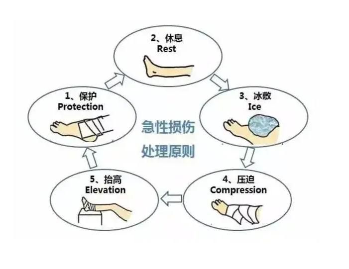 Treatment of sprains