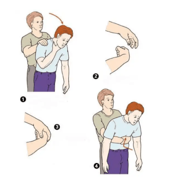 Heimlich Maneuver Training