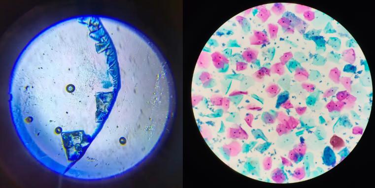 Cells under the microscope