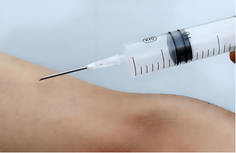 Intramuscular Injection